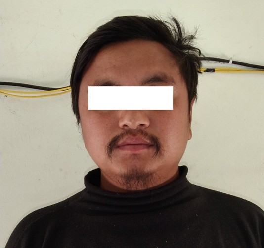 आफ्नै दाइको हत्या गर्ने भाई पक्राउ